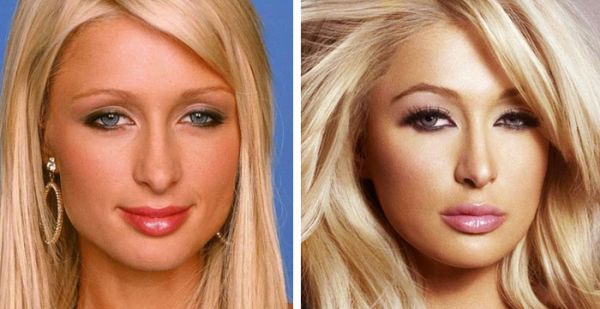 Paris Hilton antes y después